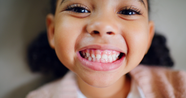 When Is Dental Bonding For Kids Necessary?